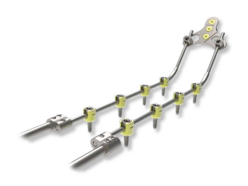 OXIS PLUS - Occipitocervical Fixation System