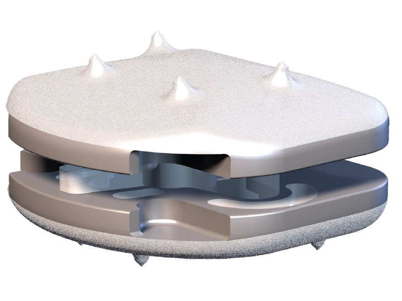 Spine Innovations